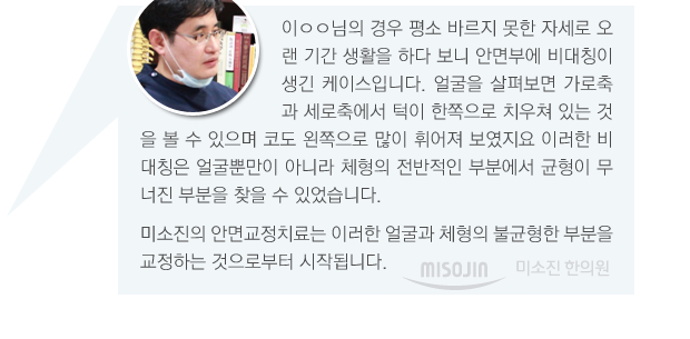 이성민님은 이목구비부터 턱, 어깨, 허리, 골반이 전체적으로 연결된 골격구조자체가 틀어져서 얼굴비대칭이 발생하게 되었습니다. 이러한 비대칭은 어느 한 부분의 교정이 아니라 전신에 걸친 교정을 통해 서서히 바르게 돌아오게 됩니다.